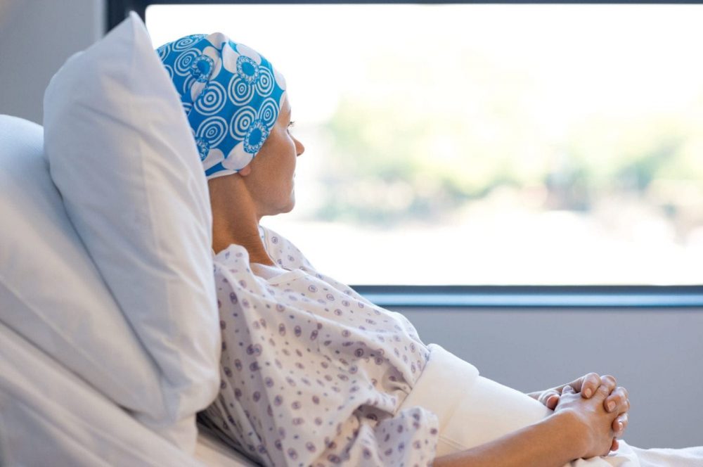 Female With Permanent Hair Loss Stock Photo