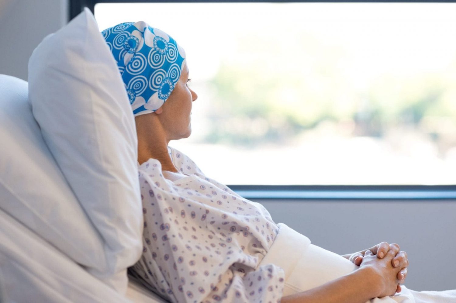 Female With Permanent Hair Loss Stock Photo