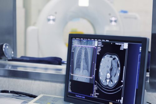 Computer Monitor Inside Hospital Room Stock Photo